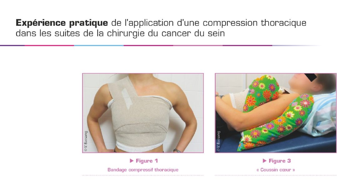 Compression thoracique après chirurgie du sein