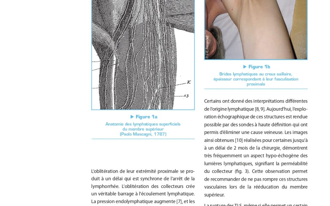 Evolution des vaisseaux lymphatiques après chirurgie axillaire